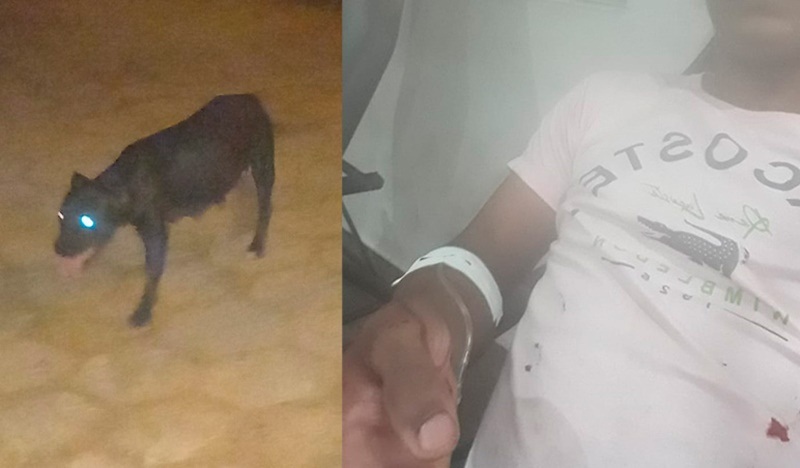 Homem  atacado por pitbull é socorrido ao hospital em Itamaraju